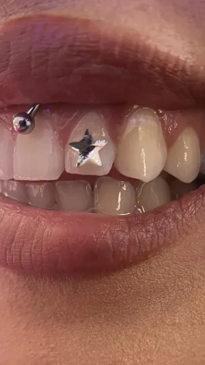 Star Decorated Smile With Piercings