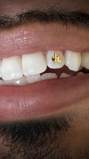 Small Star And Flame Tooth Decorations