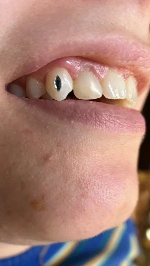 Black Diamond Tooth Art