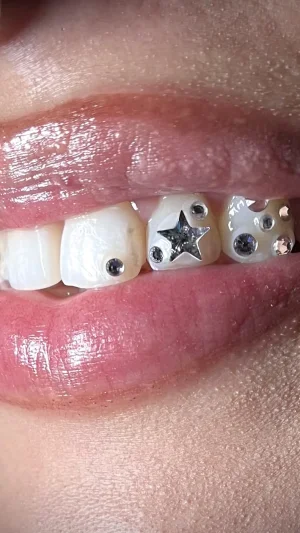 Sparkly Star Tooth Gems