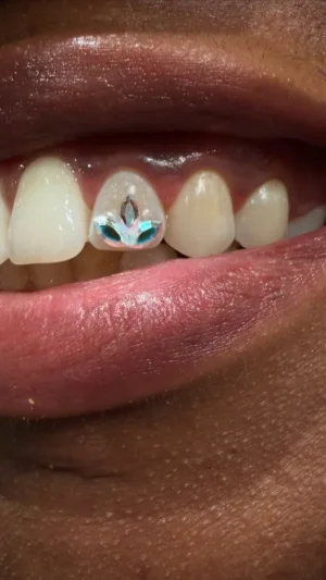 Gemstone Decorated Tooth