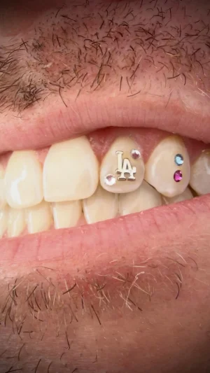 LA Letters Tooth Bling