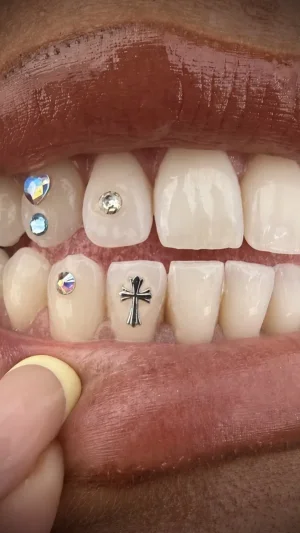 Blackwork Cross and Gemstones Teeth
