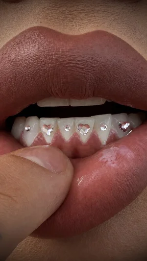 Microrealism Heart Gemmed Teeth