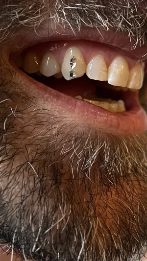 Beard And Teeth Close Up
