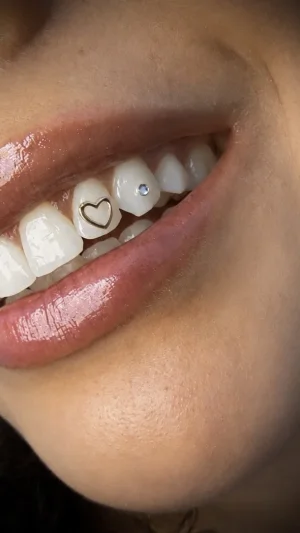Heart And Gem Tooth Decorations