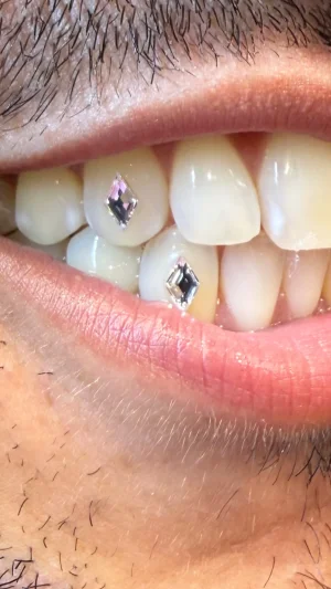 Diamond Stud Microrealism Teeth