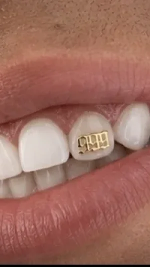 Gold Grill Tooth Jewelry