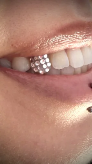 Metal Dental Grill With Piercings